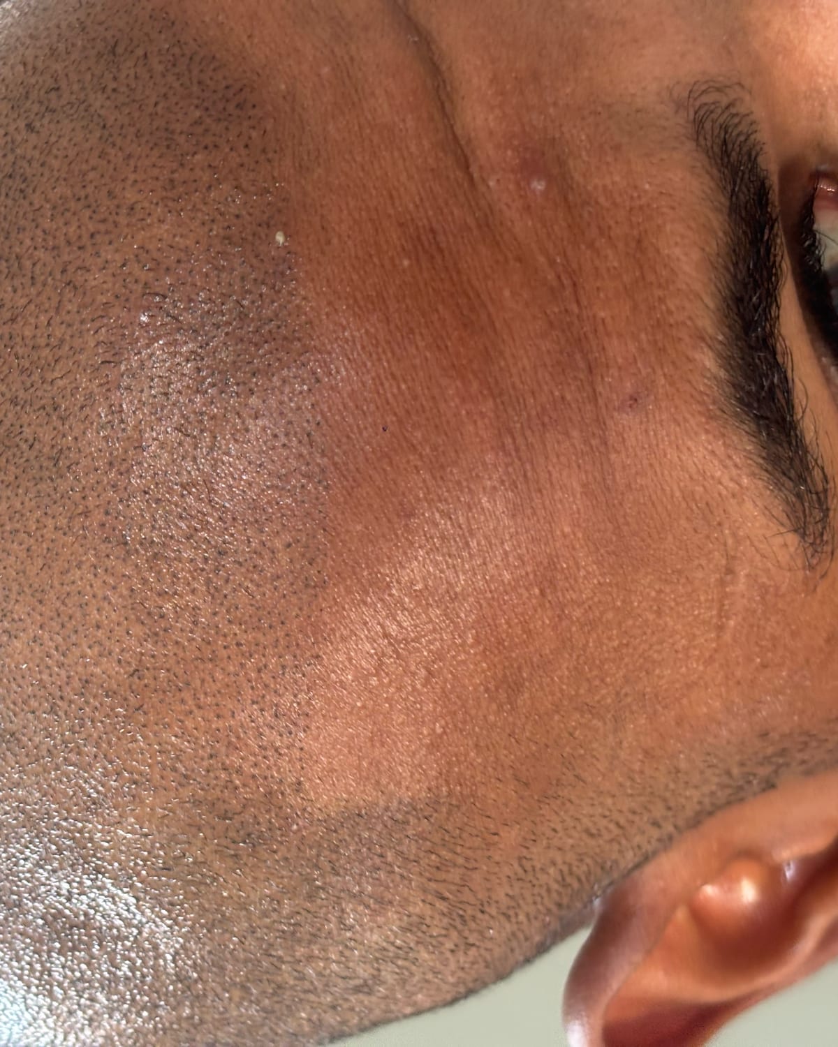 A photograph of the founder's own head after his first session, under a harsh overhead bulb